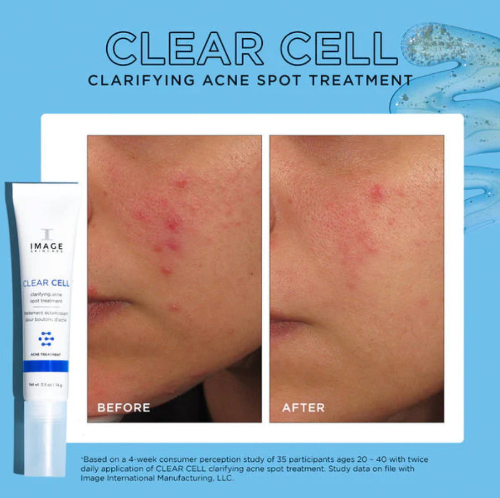 IMAGE Skincare CLEAR CELL Clarifying Salicylic Blemish Gel